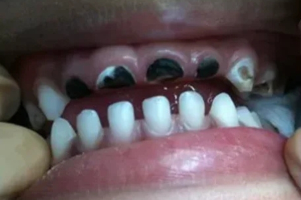 Before